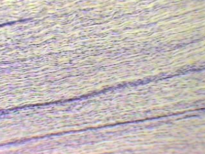 Dense Connective Tissue - With Parallel Fibers