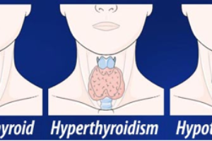 Thyroid