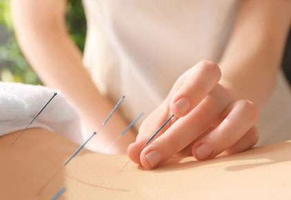 Acupuncture Closeup